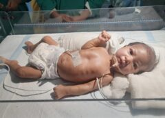 New Lease on Life: Doctors at Vivekanand Hospital Perform Complex Surgery on 45-Day-Old Infant